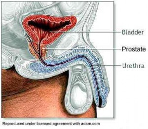 prostate picture 1